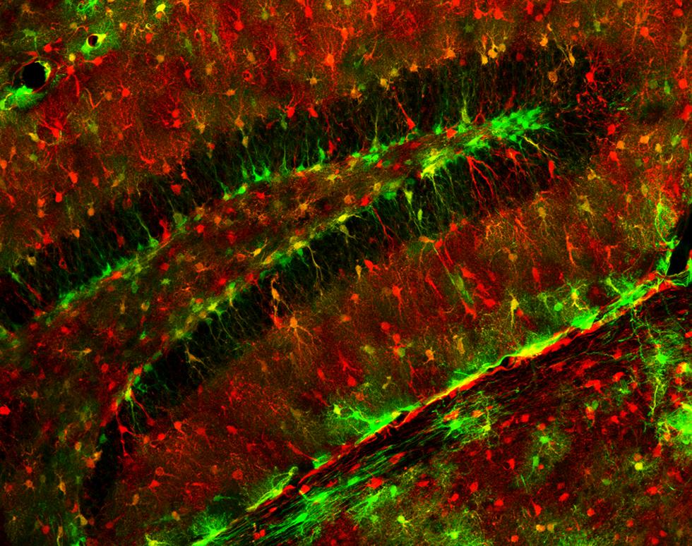 Rat hippocampus - GPP tagged and immunostained stem cell markers